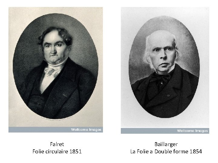 Falret Folie circulaire 1851 Baillarger La Folie a Double forme 1854 