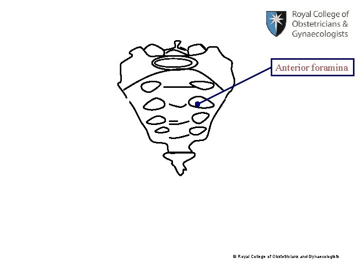 Anterior foramina © Royal College of Obstetricians and Gynaecologists 