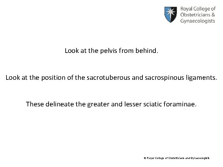 Look at the pelvis from behind. Look at the position of the sacrotuberous and