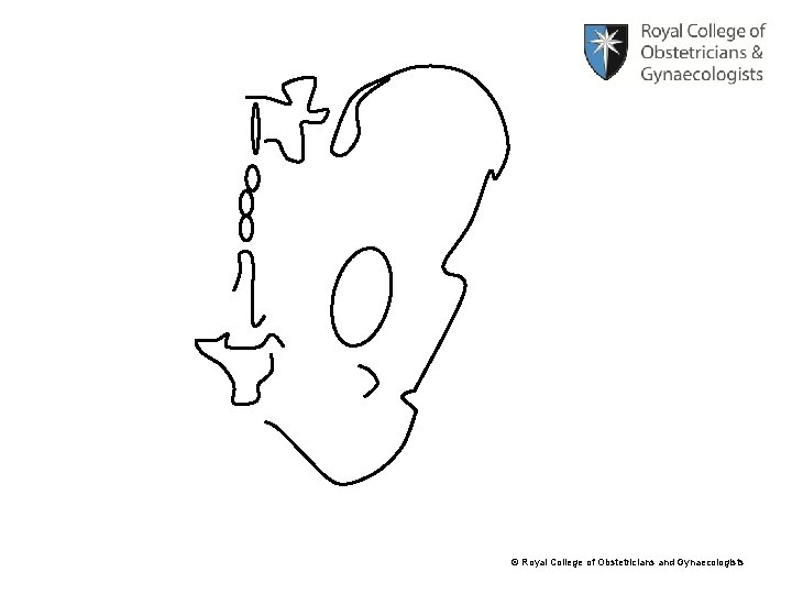 © Royal College of Obstetricians and Gynaecologists 
