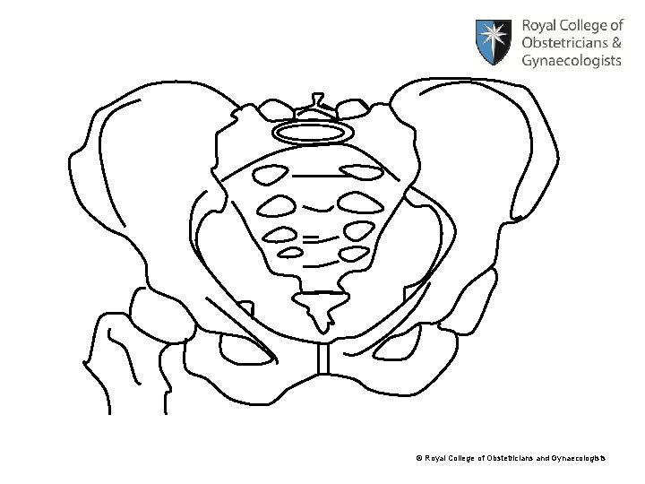 © Royal College of Obstetricians and Gynaecologists 