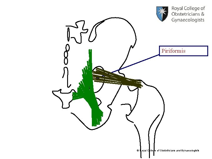 Piriformis © Royal College of Obstetricians and Gynaecologists 