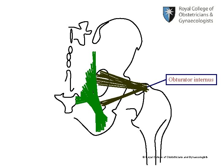 Obturator internus © Royal College of Obstetricians and Gynaecologists 