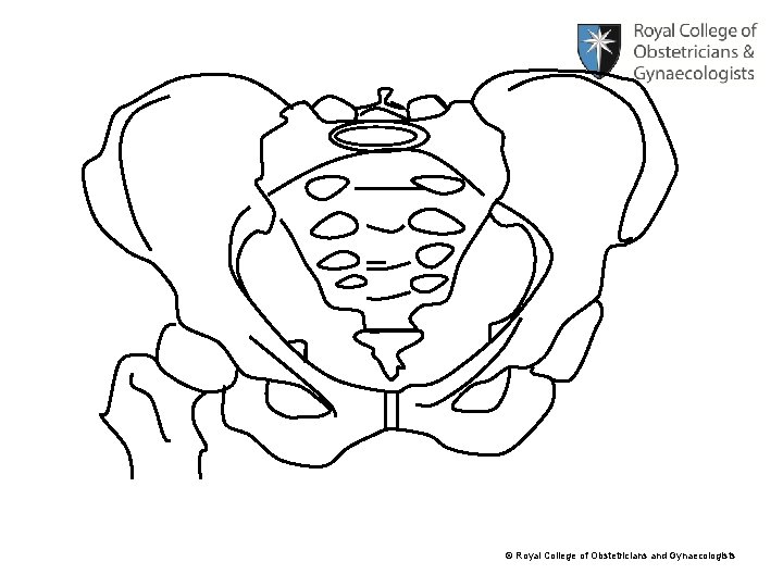 © Royal College of Obstetricians and Gynaecologists 