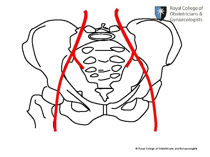 © Royal College of Obstetricians and Gynaecologists 