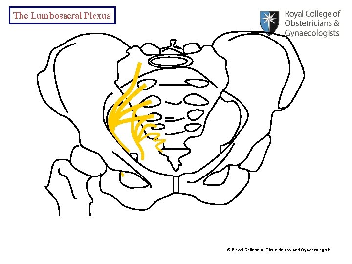 The Lumbosacral Plexus © Royal College of Obstetricians and Gynaecologists 