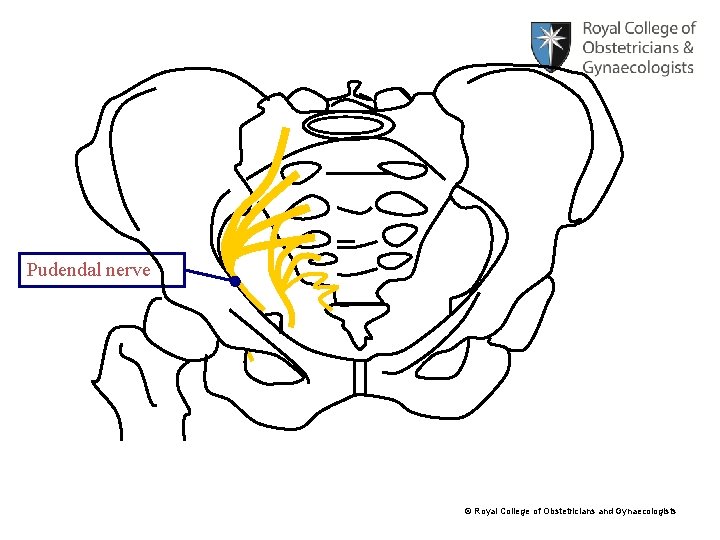 Pudendal nerve © Royal College of Obstetricians and Gynaecologists 