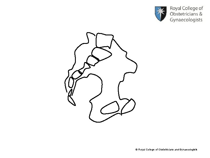 © Royal College of Obstetricians and Gynaecologists 
