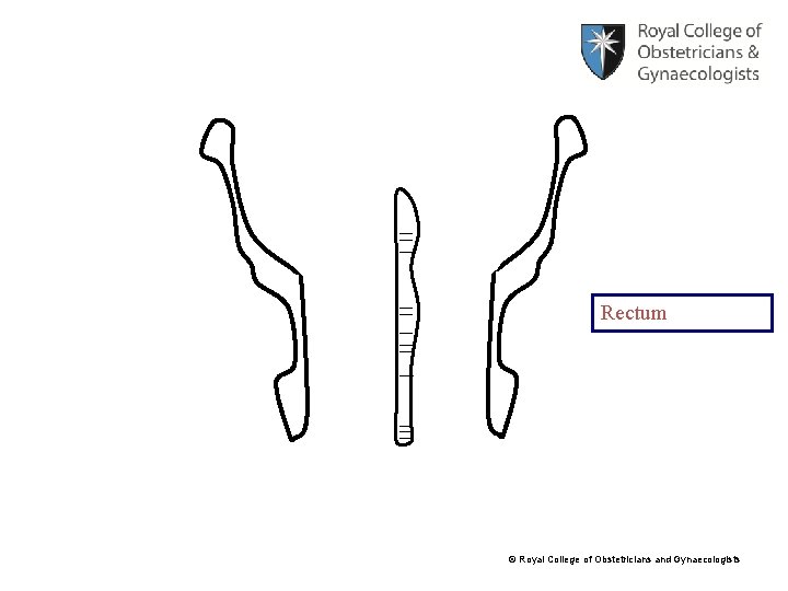 Rectum © Royal College of Obstetricians and Gynaecologists 