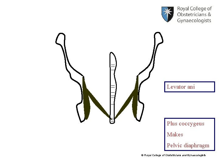 Levator ani Plus coccygeus Makes Pelvic diaphragm © Royal College of Obstetricians and Gynaecologists