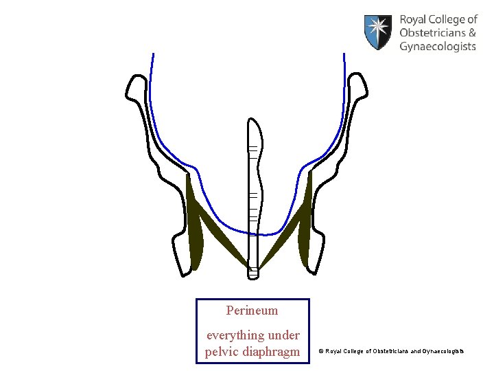 Perineum everything under pelvic diaphragm © Royal College of Obstetricians and Gynaecologists 