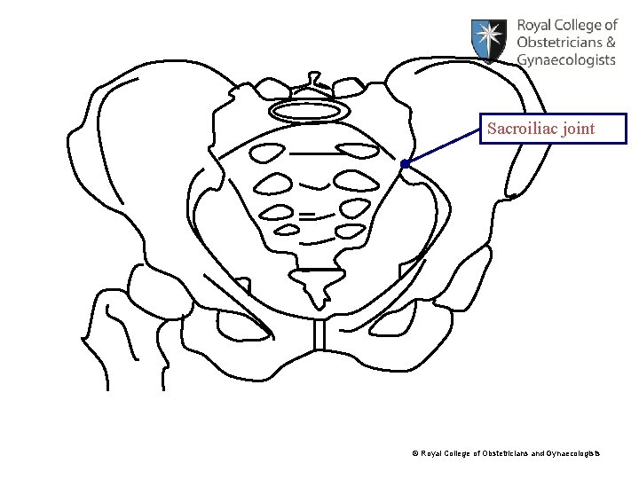 Sacroiliac joint © Royal College of Obstetricians and Gynaecologists 