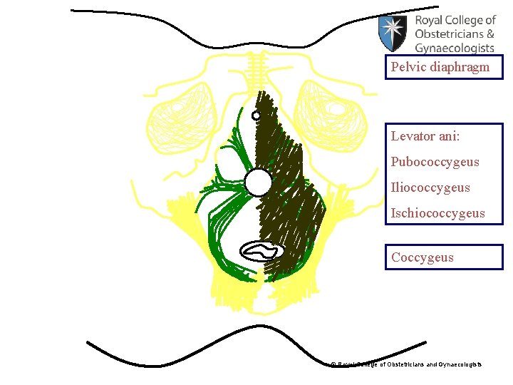 Pelvic diaphragm Levator ani: Pubococcygeus Iliococcygeus Ischiococcygeus Coccygeus © Royal College of Obstetricians and