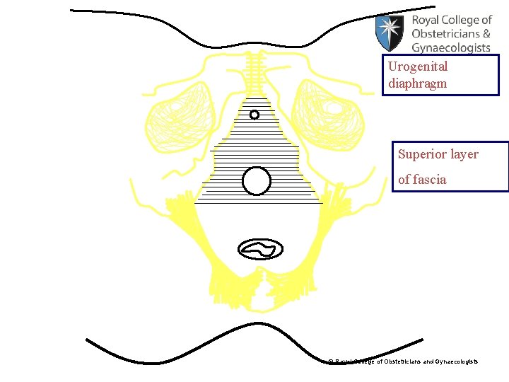 Urogenital diaphragm Superior layer of fascia © Royal College of Obstetricians and Gynaecologists 