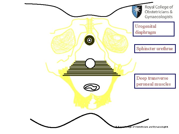 Urogenital diaphragm Sphincter urethrae Deep transverse peroneal muscles © Royal College of Obstetricians and