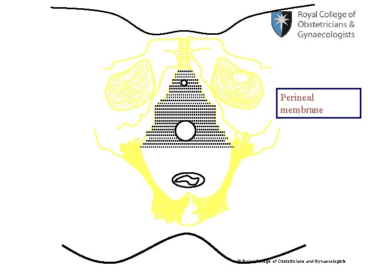 Perineal membrane © Royal College of Obstetricians and Gynaecologists 