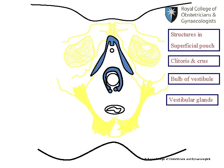 Structures in Superficial pouch Clitoris & crus Bulb of vestibule Vestibular glands © Royal