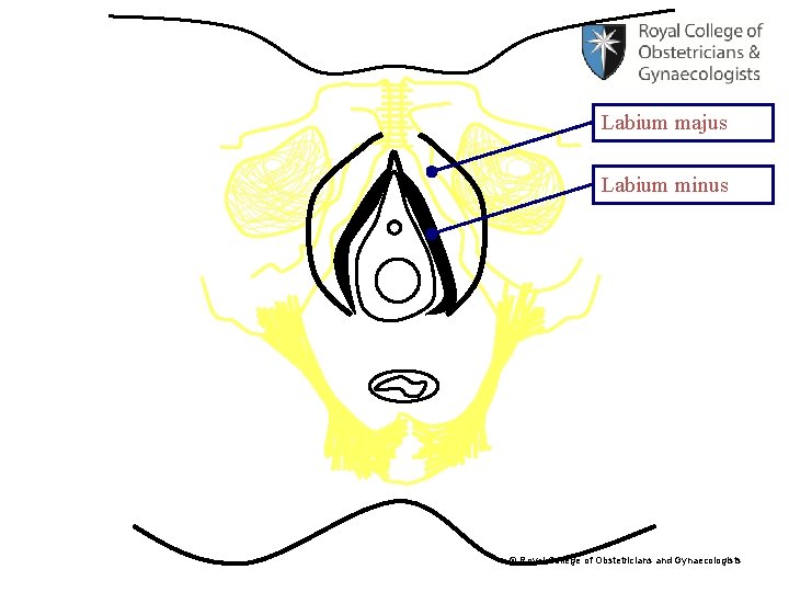 Labium majus Labium minus © Royal College of Obstetricians and Gynaecologists 