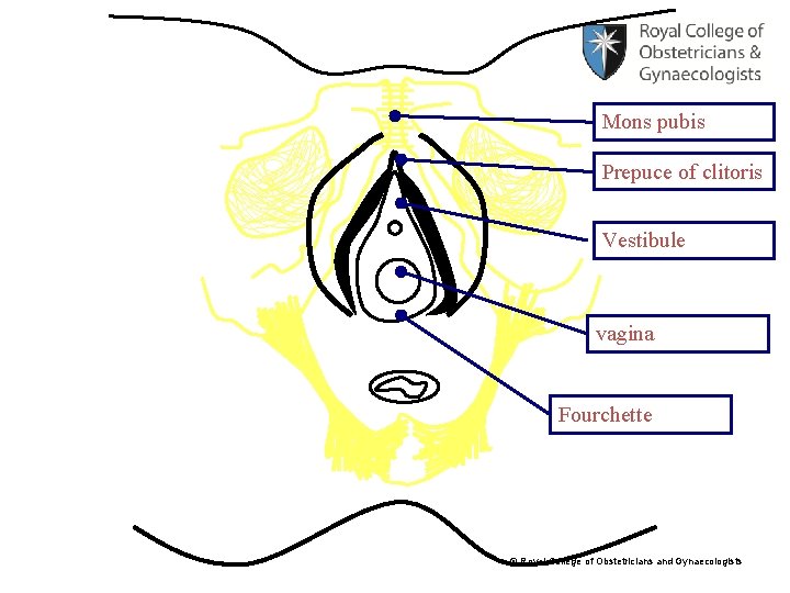 Mons pubis Prepuce of clitoris Vestibule vagina Fourchette © Royal College of Obstetricians and