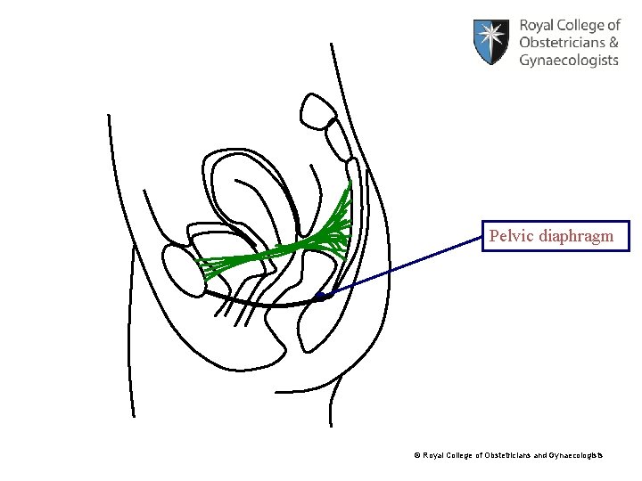 Pelvic diaphragm © Royal College of Obstetricians and Gynaecologists 