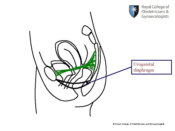 Urogenital diaphragm © Royal College of Obstetricians and Gynaecologists 