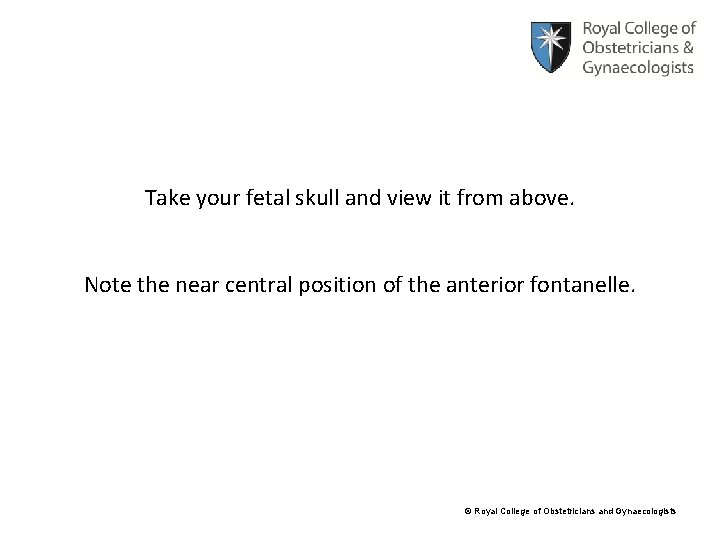 Take your fetal skull and view it from above. Note the near central position