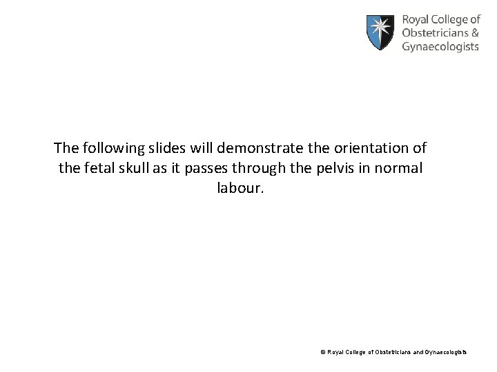 The following slides will demonstrate the orientation of the fetal skull as it passes
