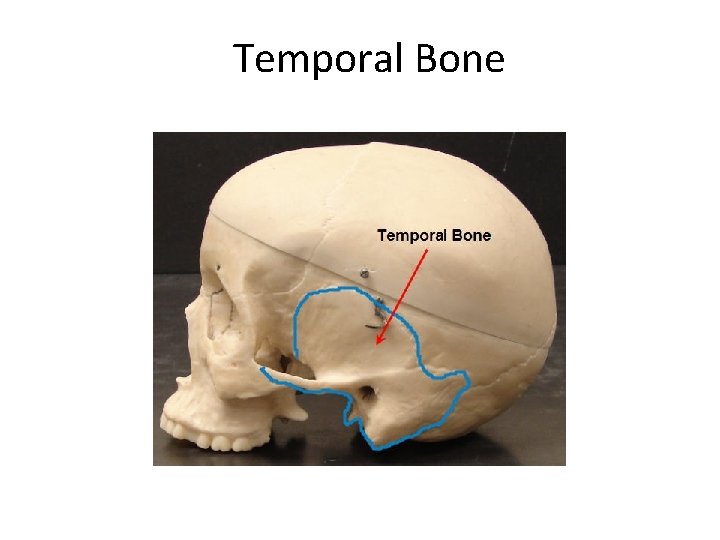 Temporal Bone Created by Scott Ford © 2007 All rights reserved 