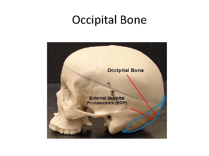 Occipital Bone Created by Scott Ford © 2007 All rights reserved 