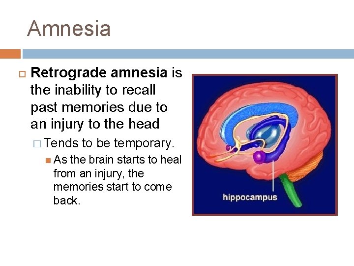 Amnesia Retrograde amnesia is the inability to recall past memories due to an injury