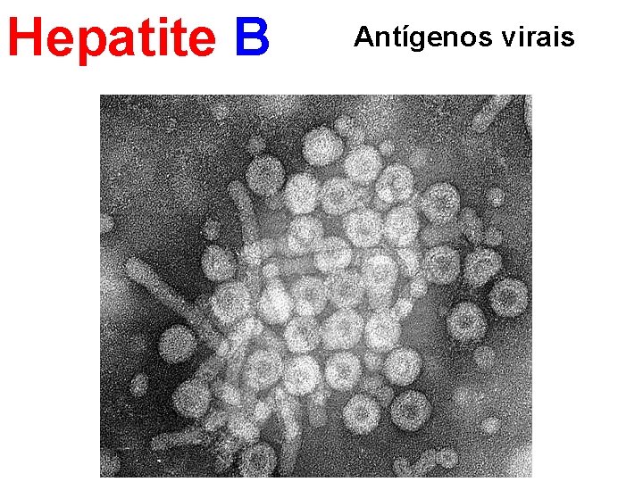 Hepatite B Antígenos virais 