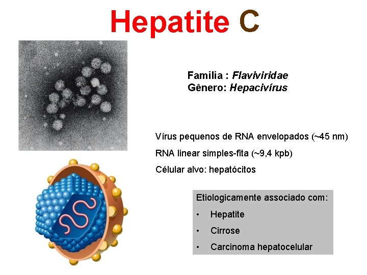 Hepatite C Familia : Flaviviridae Gênero: Hepacivírus Vírus pequenos de RNA envelopados (~45 nm)
