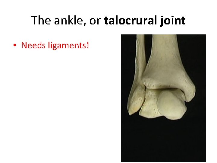 The ankle, or talocrural joint • Needs ligaments! 