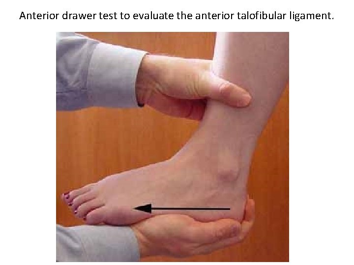 Anterior drawer test to evaluate the anterior talofibular ligament. 