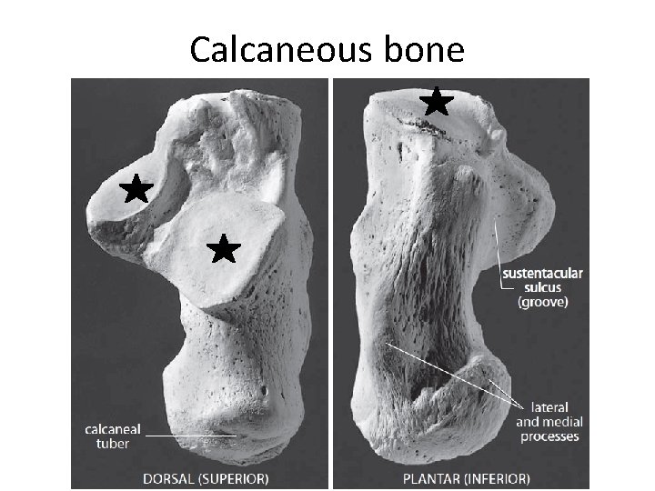 Calcaneous bone 