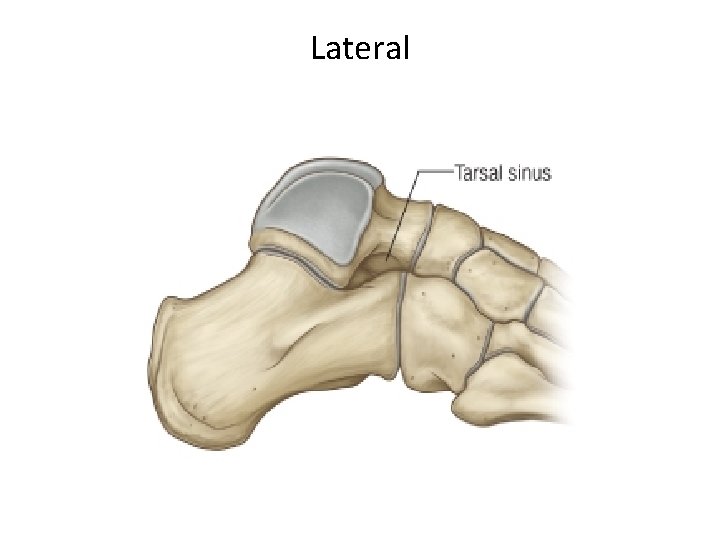 Lateral 
