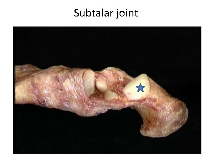 Subtalar joint 