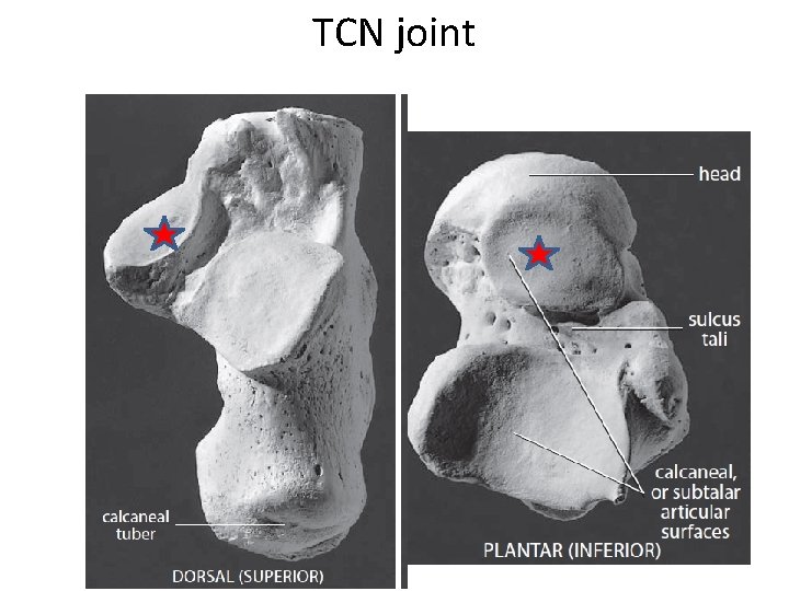TCN joint 