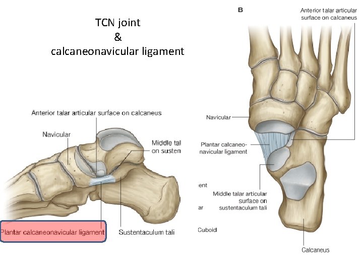 TCN joint & calcaneonavicular ligament 