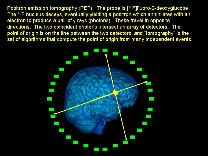 Positron emission tomography (PET). The probe is [18 F]fluoro-2 -deoxyglucose. The 18 F nucleus