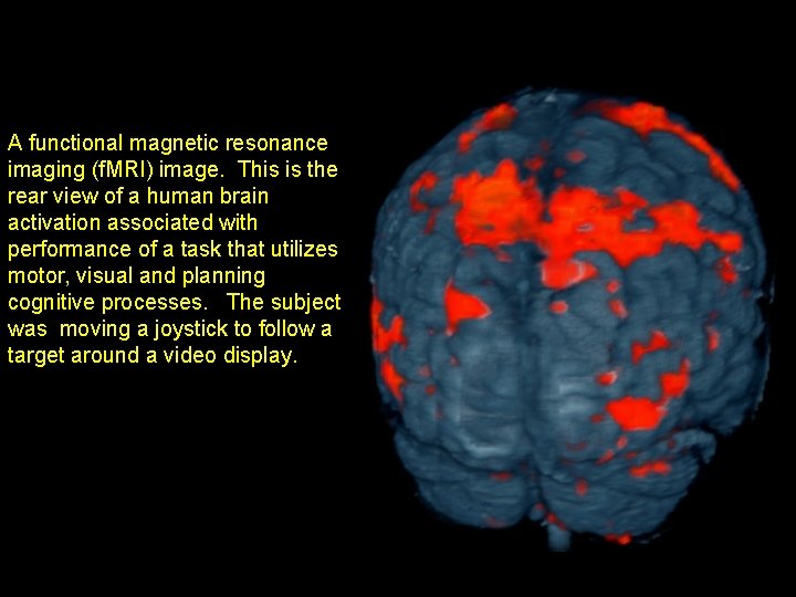 A functional magnetic resonance imaging (f. MRI) image. This is the rear view of A functional magnetic resonance imaging (f. MRI) image. This is the rear view of