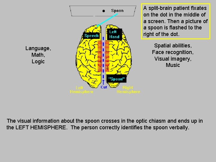 A split-brain patient fixates on the dot in the middle of a screen. Then A split-brain patient fixates on the dot in the middle of a screen. Then