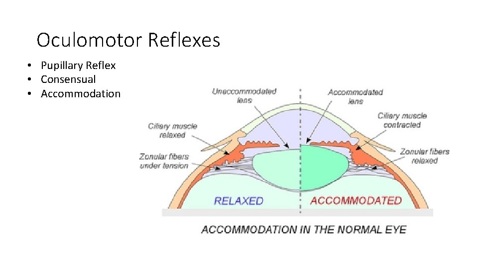 Oculomotor Reflexes • Pupillary Reflex • Consensual • Accommodation 