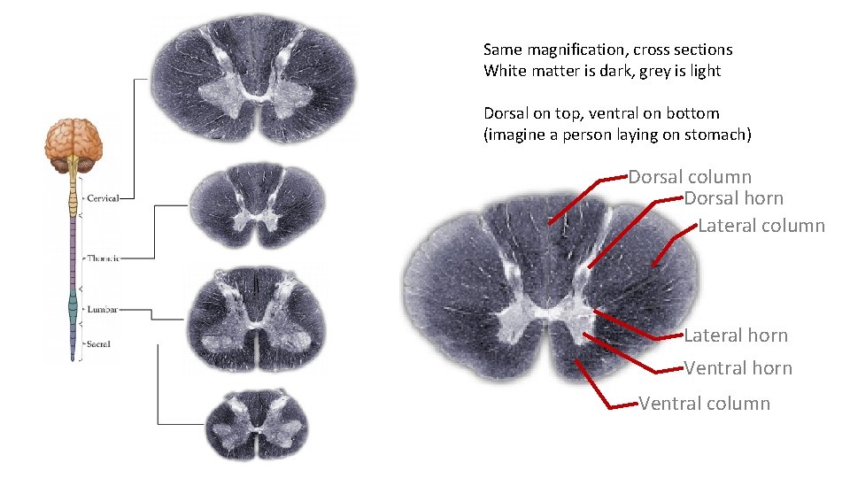 Same magnification, cross sections White matter is dark, grey is light Dorsal on top,