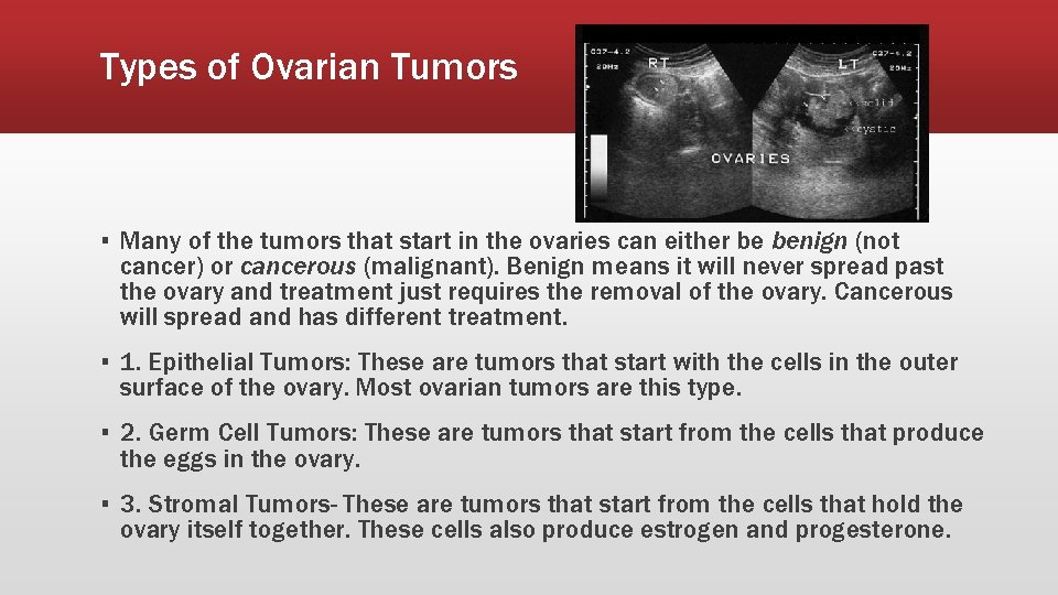 Types of Ovarian Tumors ▪ Many of the tumors that start in the ovaries