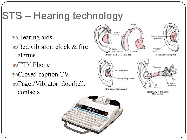 STS – Hearing technology Hearing aids Bed vibrator: clock & fire alarms TTY Phone STS – Hearing technology Hearing aids Bed vibrator: clock & fire alarms TTY Phone