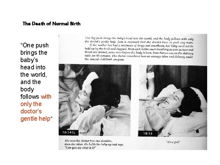 The Death of Normal Birth “One push brings the baby’s head into the world,