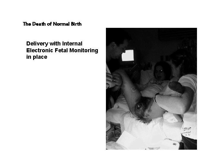 The Death of Normal Birth Delivery with Internal Electronic Fetal Monitoring in place 