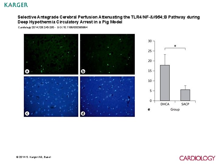 Selective Antegrade Cerebral Perfusion Attenuating the TLR 4/NF-κ B Pathway during Deep Hypothermia Circulatory