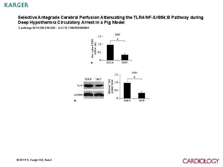 Selective Antegrade Cerebral Perfusion Attenuating the TLR 4/NF-κ B Pathway during Deep Hypothermia Circulatory